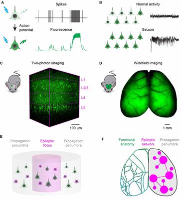 The Enlightened Brain: Novel Imaging Methods Focus on Epileptic Networks at Multiple Scales